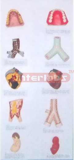 HANGING HUMAN COMPARISION MODEL BETWEEN HEALTH ORGANS AND SMOKING Manufacturers and Suppliers From Ambala India