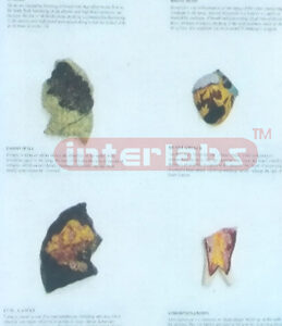 HUMAN THE CONSEQUENCES OF SMOKING HANGING WOODEN PLATE Manufacturers and Suppliers From Ambala India
