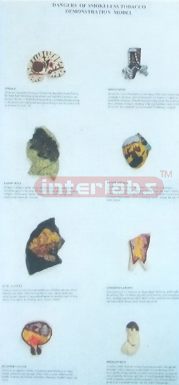 HUMAN THE CONSEQUENCES OF SMOKING HANGING WOODEN PLATE Manufacturers and Suppliers From Ambala India