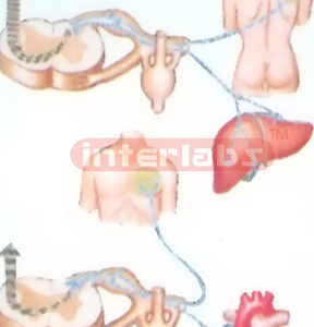 DISEASE REFLEX COLLECTION Manufacturers and Suppliers From Ambala India