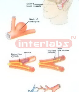 HUMAN YOUNG HAEMORRHAGE MODEL FOR DEMONSTRATING Manufacturers and Suppliers From Ambala India