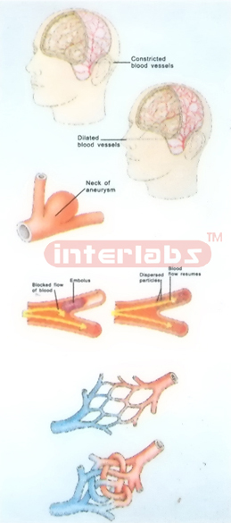 HUMAN YOUNG HAEMORRHAGE MODEL FOR DEMONSTRATING Manufacturers and Suppliers From Ambala India