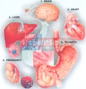 HANGING HUMAN ALCOHOL DISEASES MODEL DEMONSTRATING Manufacturers and Suppliers From Ambala India