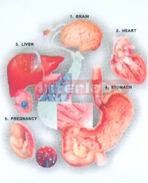 HANGING HUMAN ALCOHOL DISEASES MODEL DEMONSTRATING Manufacturers and Suppliers From Ambala India