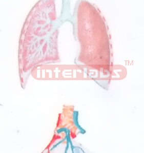 HUMAN RESPIRATORY SYSTEM WITH HANGING ENLARGED ALVEOLI (RELIEF) Manufacturers and Suppliers From Ambala India