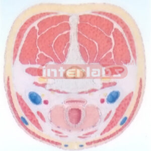 HUMAN CROSS-SECTION MODEL OF THE NECK Manufacturers and Suppliers From Ambala India