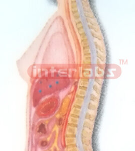 HANGING FEMALE INNER ORGANS MODEL  IN ABDOMINAL CAVITY Manufacturers and Suppliers From Ambala India