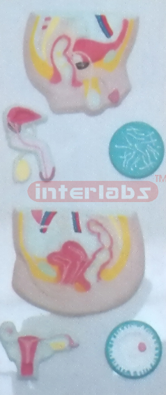 HUMAN MALE& FEMALE GENITAL & URINARY SYSTEM PLASTIC PLATE Manufacturers and Suppliers From Ambala India