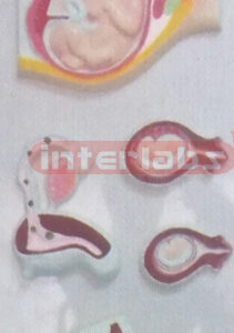 HUMAN GENITAL UTERUS & PREGNANCY SERIES PLASTIC PLATE Manufacturers and Suppliers From Ambala India
