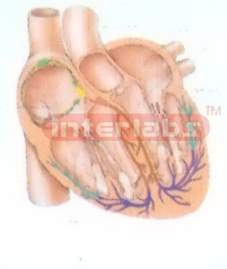 HANGING HUMAN CONDUCTING BYPASS OF THE HEART Manufacturers and Suppliers From Ambala India