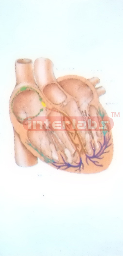 HANGING HUMAN CONDUCTING BYPASS OF THE HEART Manufacturers and Suppliers From Ambala India