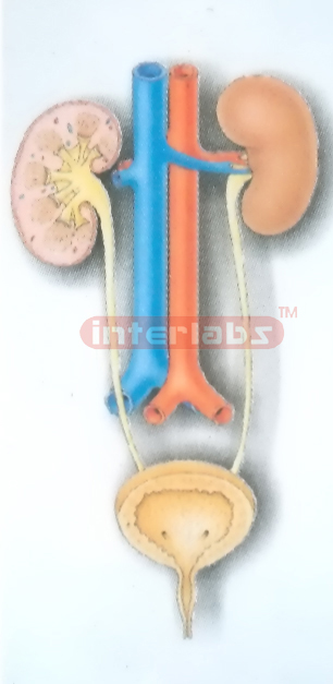 HANGING HUMAN COMMON DISEASE MODEL OF UROGENITAL SYSTEM Manufacturers and Suppliers From Ambala India