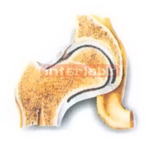 HUMAN HIP JOINT (CORONAL SECTION) MODEL Manufacturers and Suppliers From Ambala India