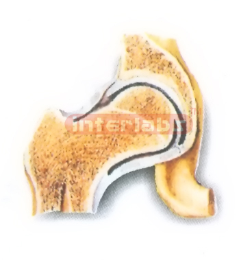 HUMAN HIP JOINT (CORONAL SECTION) MODEL Manufacturers and Suppliers From Ambala India