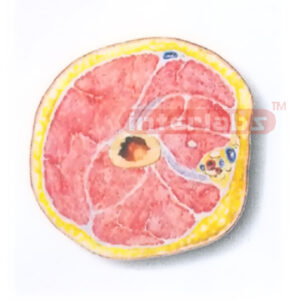 HUMAN TRANSVERSE SECTION MODEL THROUGH THE PORXIMAL 1/3 OF THE RIGHT ARM (A) Manufacturers and Suppliers From Ambala India