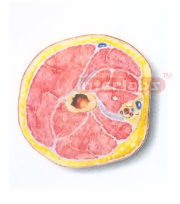 HUMAN TRANSVERSE SECTION MODEL THROUGH THE PORXIMAL 1/3 OF THE RIGHT ARM (A) Manufacturers and Suppliers From Ambala India