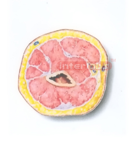 HUMAN TRANSVERSE SECTION MODEL THROUGH THE DISTAL 1/3 OF THE RIGHT ARM (C) Manufacturers and Suppliers From Ambala India