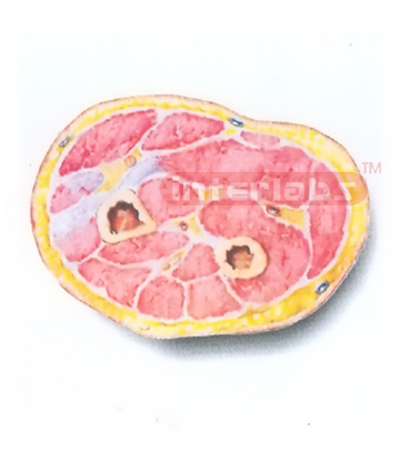 HUMAN TRANSVERSE SECTION MODEL THROUGH THE MIDDLE 1/3 OF RIGHT FOREARM (B) Manufacturers and Suppliers From Ambala India