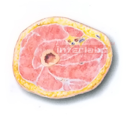 HUMAN TRANSVERSE SECTION MODEL THROUGH THE PROXIMAL 1/3 OF THE RIGHT THIGH (A) Manufacturers and Suppliers From Ambala India