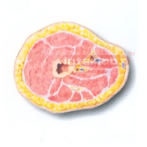 HUMAN TRANSVERSE SECTION MODEL THROUGH THE PROXIMAL 1/3 OF THE RIGHT THIGH (B) Manufacturers and Suppliers From Ambala India