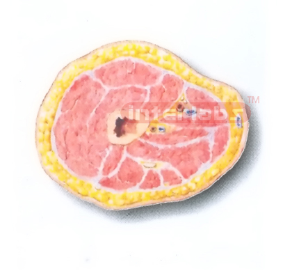 HUMAN TRANSVERSE SECTION MODEL THROUGH THE PROXIMAL 1/3 OF THE RIGHT THIGH (B) Manufacturers and Suppliers From Ambala India