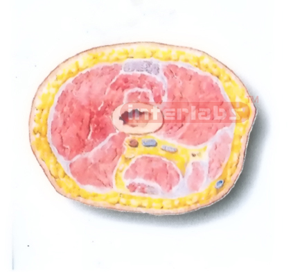 HUMAN TRANSVERSE SECTION MODEL THROUGH THE PROXIMAL 1/3 OF THE RIGHT THIGH (C) Manufacturers and Suppliers From Ambala India