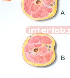 HANGING HUMAN TRANSVERSE SECTION THROUGH THE MIDDLE 1/3 OF THE RIGHT ARM (A