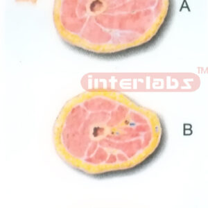 HUMAN TRANSVERSE SECTION THROUGH THE PROXIMAL 1/3 OF THE RIGHT THIGH (A