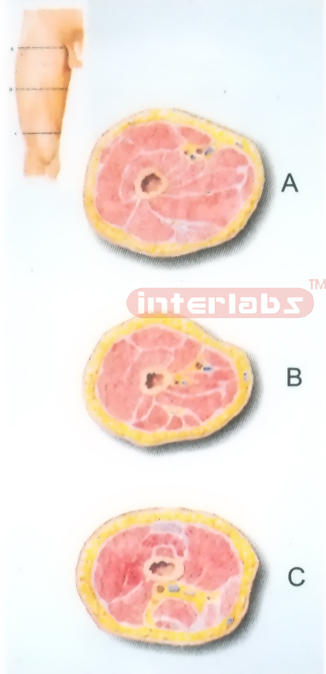 HUMAN TRANSVERSE SECTION THROUGH THE PROXIMAL 1/3 OF THE RIGHT THIGH (A