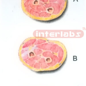 HUMAN TRANSVERSE SECTION THROUGH THE PROXIMAL 1/3 OF RIGHT FOREARM (A