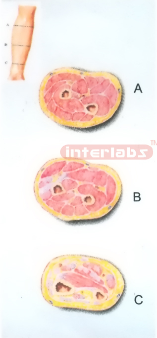 HUMAN TRANSVERSE SECTION THROUGH THE PROXIMAL 1/3 OF RIGHT FOREARM (A