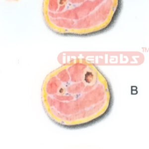 HUMAN TRANSVERSE SECTION THROUGH THE DISTAL 1/3 OF THE RIGHT LEG (A