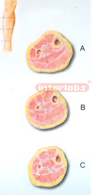 HUMAN TRANSVERSE SECTION THROUGH THE DISTAL 1/3 OF THE RIGHT LEG (A