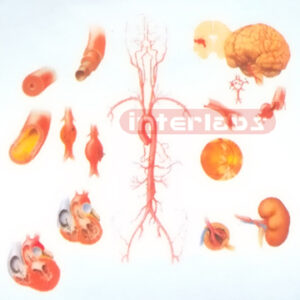 HANGING HUMAN HYPERTENSION DISEASE MODEL FOR DESCRIPTION AND DEMONSTRATION Manufacturers and Suppliers From Ambala India