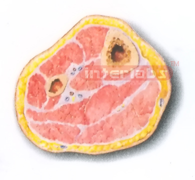 HUMAN TRANSVERSE SECTION MODEL THROUGH THE PROXIMAL 1/3 OF THE RIGHT LEG (A) Manufacturers and Suppliers From Ambala India
