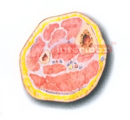 HUMAN TRANSVERSE SECTION MODEL THROUGH THE DISTAL 1/3 OF THE RIGHT LEG (C) Manufacturers and Suppliers From Ambala India