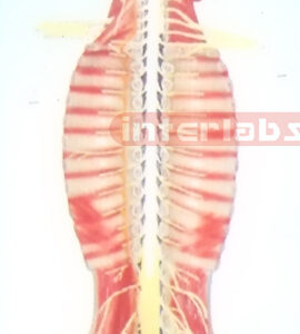 SMALL HANGING HUMAN SPINAL CORD MODEL IN SPINAL CANAL Manufacturers and Suppliers From Ambala India