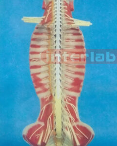 SMALL HUMAN SPINAL CORD MODEL IN SPINAL CANAL Manufacturers and Suppliers From Ambala India