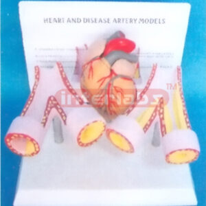 HUMAN HEART AND DISEASE ARTERY MODELS Exporter & Educational