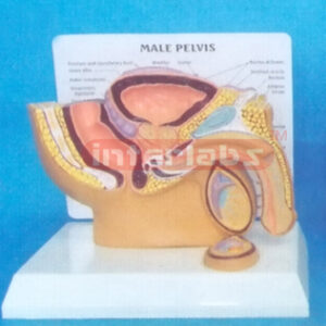 SMALL HUMAN DISEASED MALE PRIMARY / PELVIS STAND SYSTEM (D T