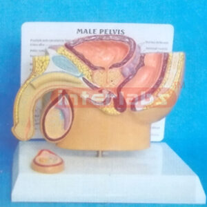 SMALL HUMAN DISEASED MALE PRIMARY / PELVIS STAND SYSTEM (E T