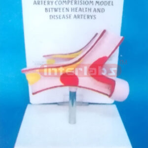 DISEASE ARTERY MODEL Exporter & Educational Laboratory Equip