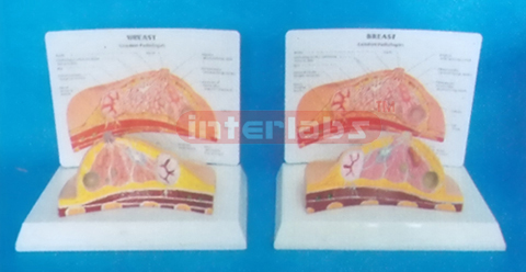 DESK-TYPE COMMON BREAST PATHOLOGIES MODEL WITH DESCRIPITON P