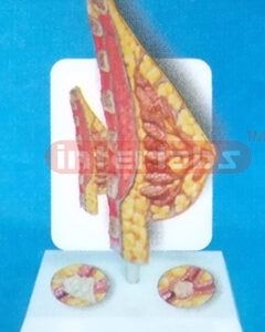 TYPE MANARY GLAND TUMOR MODEL WITH DESCRIPTION PLATE Exporte