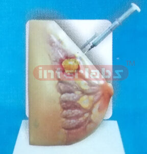 HUMARY GLAND TUMOR MODEL FOR HAND TREATING AND DEMONSTRATING