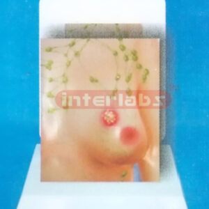 DESK MANARY TUMOR EVOLUTION MODEL WITH DESCRIPTION PLATE (1)