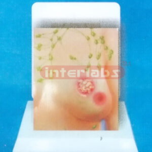 DESK MANARY TUMOR EVOLUTION MODEL WI DESCRIPTION PLATE (2) E