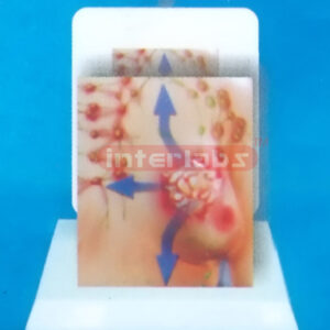 DESK MANARY TUMOR EVOLUTION MODEL WITH DESCRIPTION PLATE (4)