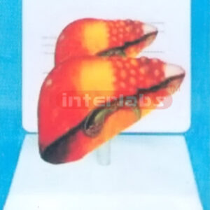 DESK-TYPE HUMAN COMMON PATHOLOGIES OF LIVER MOCDEL WITH DESC