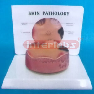 DESK-TYPE COMMON PATHOLOGIES MODEL OF SKIN CARC-INOMASERIES